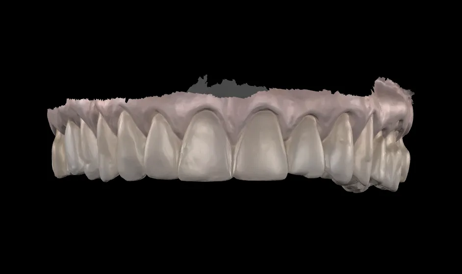 fatete dentare