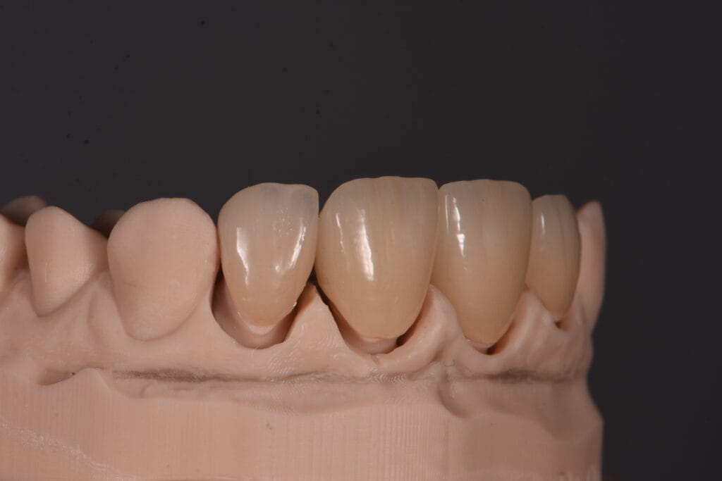 model digital dentar dinti