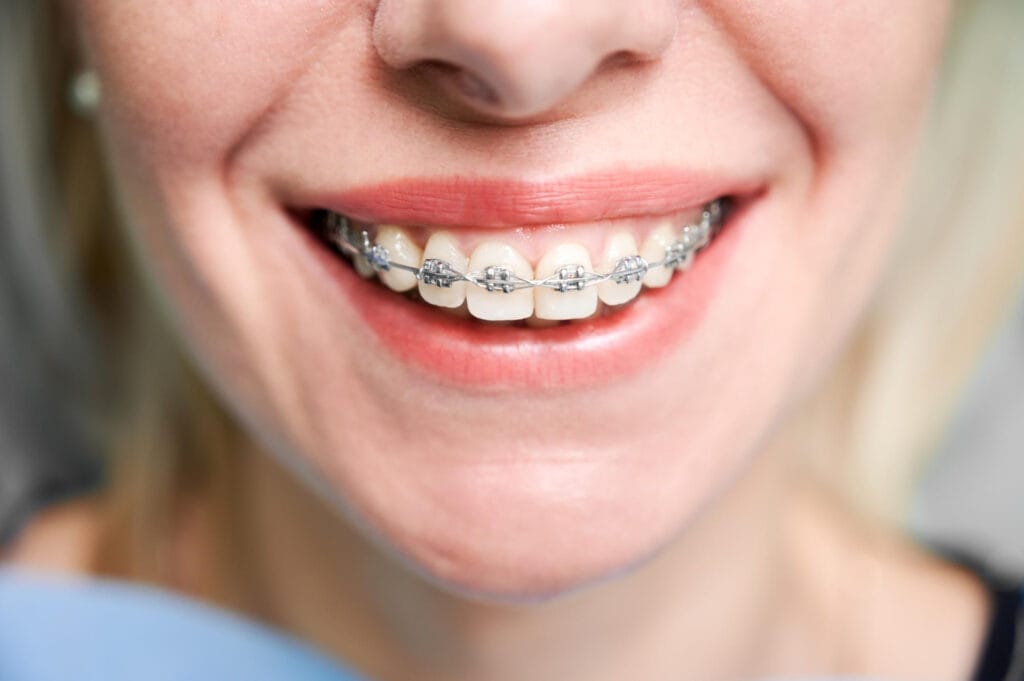 ortodont cluj aparat dentar cluj-napoca